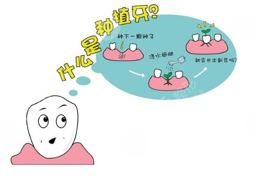 要怎么选择种植体?