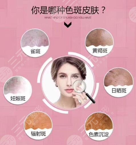 云大医院激光美容科好吗?人气医生名单+激光美肤案例合集~