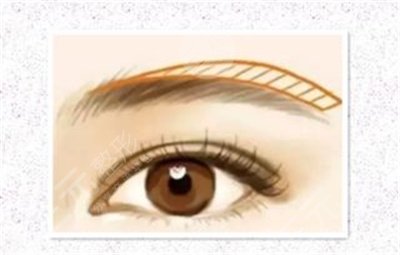 绣眉补色注意事项