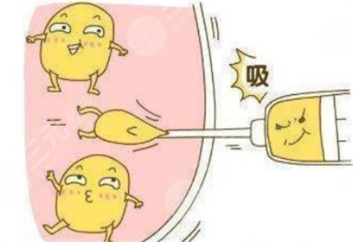手臂吸脂