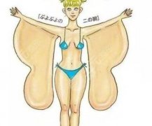 大臂环吸和蝴蝶袖吸脂的区别科普！2022纤体塑形指南为你解答~
