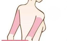 大臂环吸疼吗，多久可以消肿？2020塑形攻略带你了解手术原理！