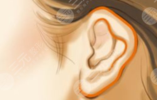 耳再造3d技术注意事项