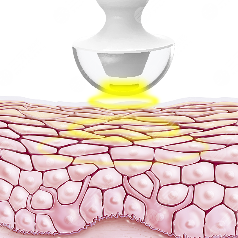 韩国人都会整容吗？