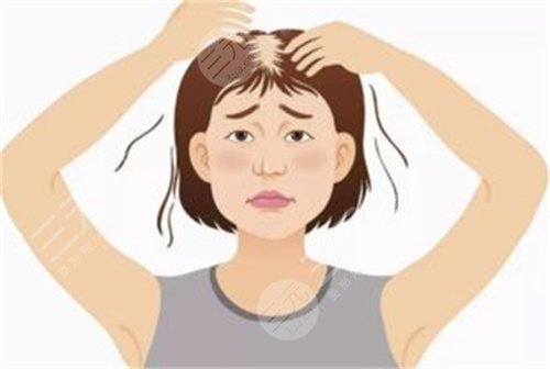 上海剑桥医院植发怎么样？植发医生名单&植发案例果对比图~
