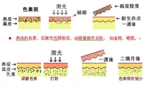 上海丽质医院正规吗？附*医推荐丨激光祛斑案例反馈~