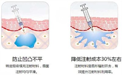 上海九院脂肪填充全脸哪个医生好？2020年医生排名前六发布~