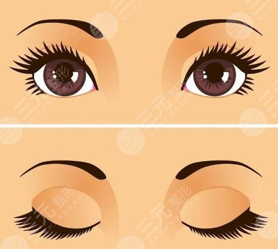 北京星爱医疗美容正规吗门诊部地址价格表曝光附双眼皮案例