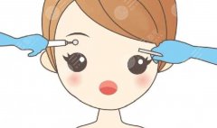 种植眉毛从哪里取毛囊，维持多久？科普手术原理&果，术前必看！