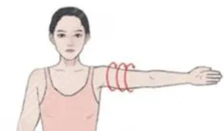 大臂环吸多久可以消肿？术后注意什么？保姆级护理指南来袭！