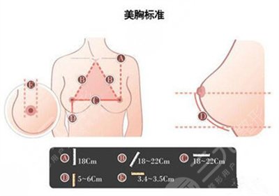 北京美莱整形医院隆胸案例
