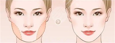 陈都灵证件照原图火了