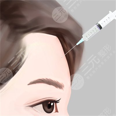王志坚医生脂肪自体填充案例