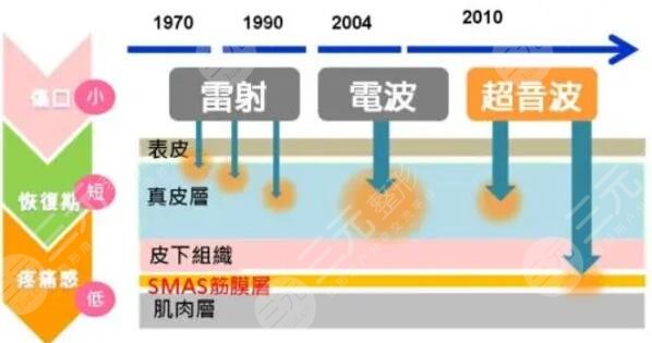 像束激光除皱的果怎么样?有果照片吗? 像束激光除皱的果怎么样?有果照片吗?