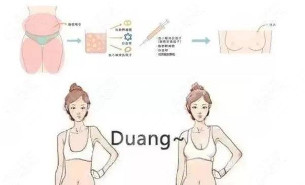 邵阳妙桃琴面假体丰胸价格多少?是怎样的收费标准? 邵阳妙桃琴面假体丰胸价格多少?是怎样的收费标准?
