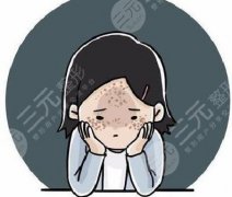 彩光祛斑果怎么样？有副作用吗？