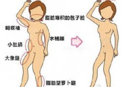 天津做水动力环形吸脂腰腹部多少钱? 天津做水动力环形吸脂腰腹部多少钱?