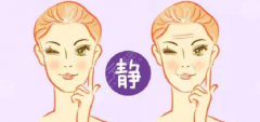 怎么去除眉间的川字纹 果好不好呢? 怎么去除眉间的川字纹 果好不好呢?