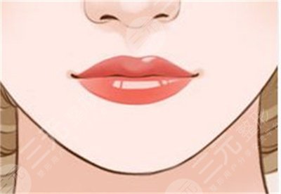 北京华真堂医疗整形注射丰唇案例