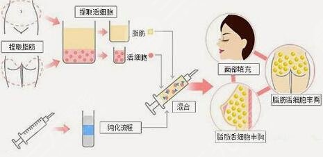 手术之后