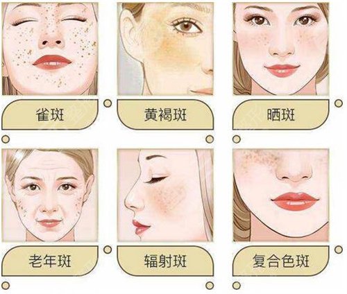 上海氧颜医疗整形医院整形案例2