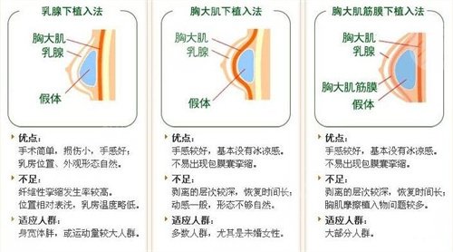 重庆西南医院案例1：