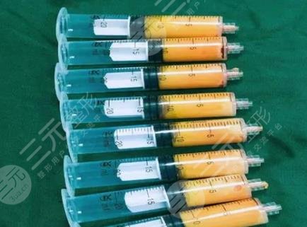 脂肪胶是什么材料