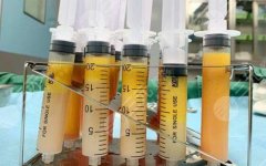 脂肪胶和自体脂肪区别科普！填充哪个好？这钱值得花！