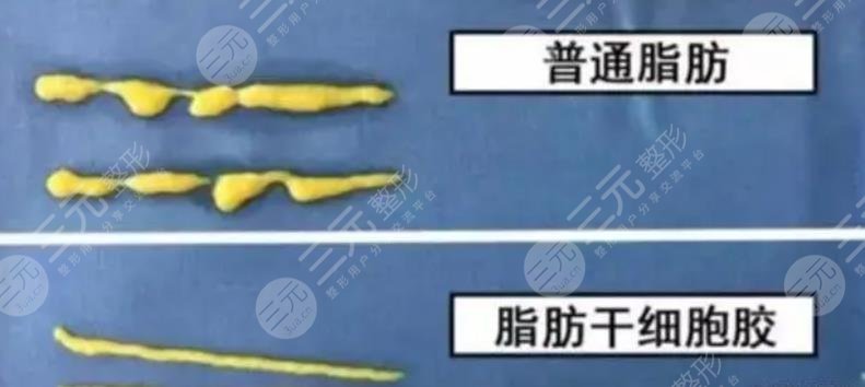 脂肪胶是什么材料