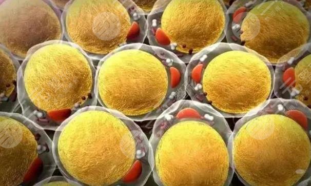 脂肪胶和自体脂肪区