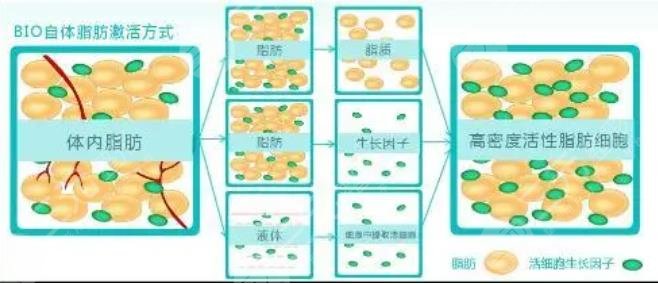 脂肪胶和自体脂肪区