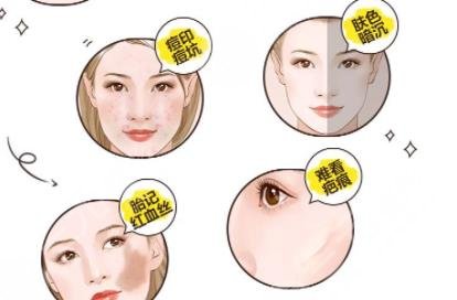 超激光美肤激光美白