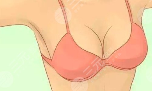 棉花糖隆胸真的不疼吗?可信吗?棉花糖隆胸案例术后:S曲线爆美!