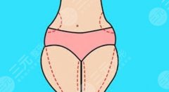 大腿环吸多久恢复？科普！恢复期护理攻略超体贴分享！