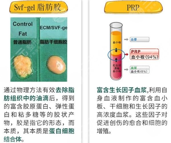 脂肪胶填充胸部果怎么样,多少钱?2022美波攻略带你认识脂肪丰胸! 脂肪胶填充胸部果怎么样,多少钱?2022美波攻略带你认识脂肪丰胸!