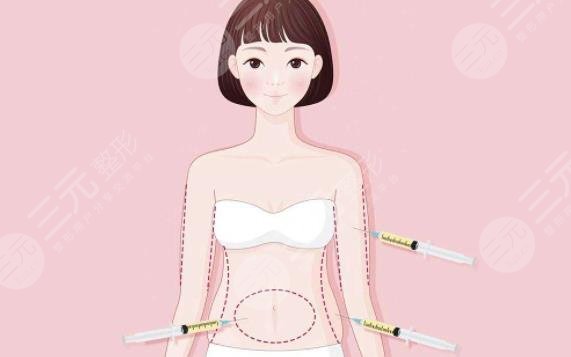 马甲线吸脂
