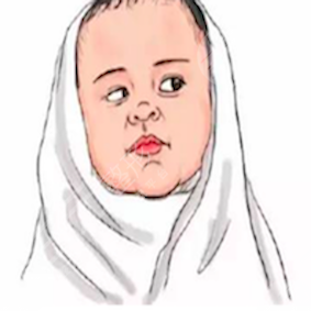 贵阳美贝尔整形口碑如何？诚意分享B****术后对比