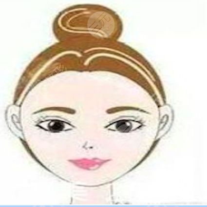 下颌角截骨前后果对比|四川美莱整形反馈