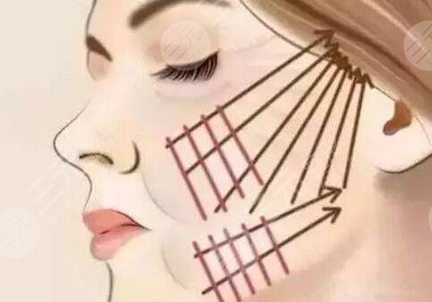 上海九院面部提升特色项目