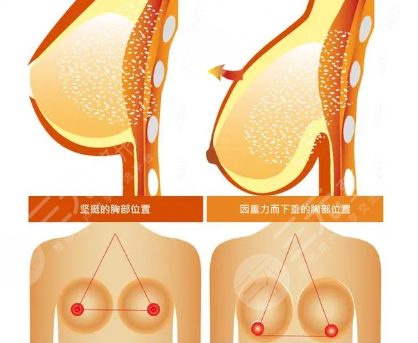 曼托隆胸的手感和真的一样吗