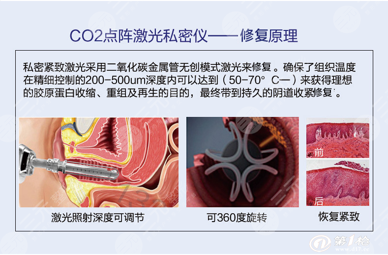 二氧化碳私密激光怎么样？科普果！紧致新生，握紧“幸福”~