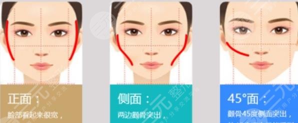 下颌角