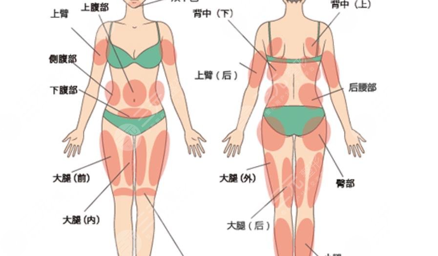 吸脂