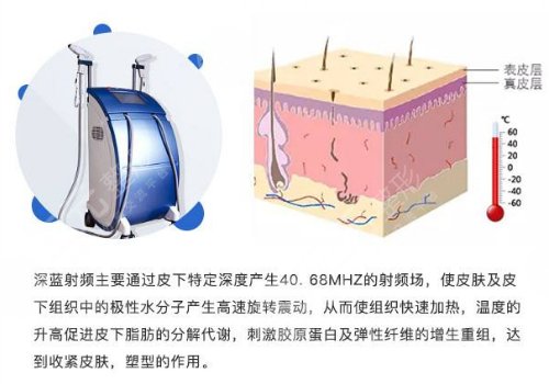 【抗衰指南】深蓝射频紧肤成好吗?术后多久恢复?护理小技巧~ 【抗衰指南】深蓝射频紧肤成好吗?术后多久恢复?护理小技巧~