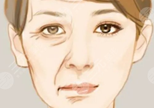 深蓝射频紧肤手术要多久才能恢复?