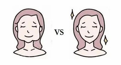 上海磨骨医院排名榜单哪里好价格表明细李志海磨骨案例果