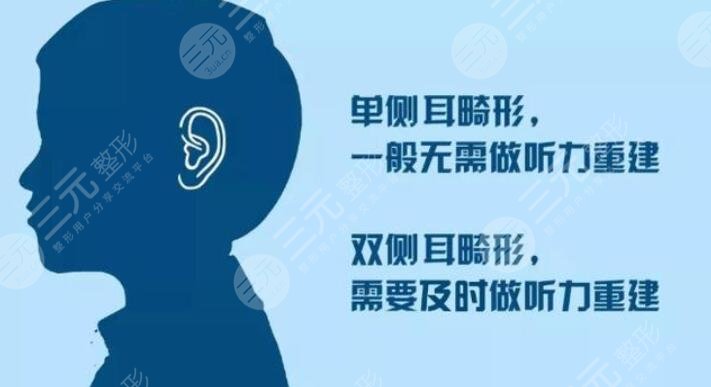 八大处杨庆华小耳畸形修复案例