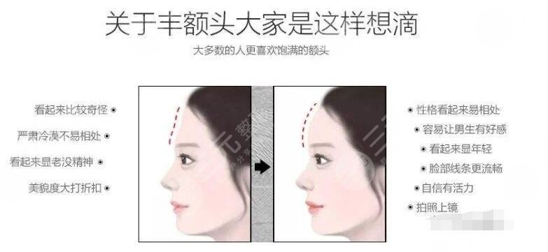 八大处王永前面部脂肪填充案例