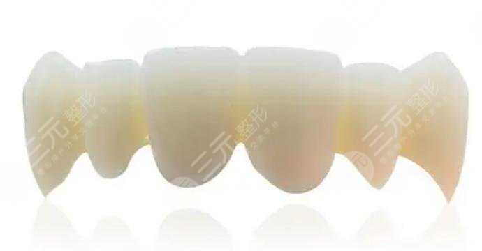 全瓷牙套