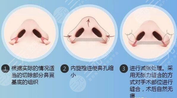 广州整形医院